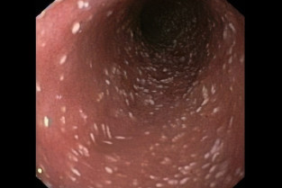 68e71dd7ad77fe311b6f2ced80f009f5