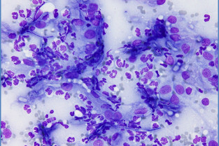 30d18b190797fd0741016e656dec0c4d