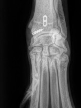 62a3790214fd950919b8a8fe06128770