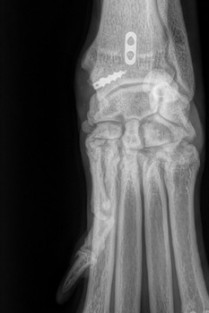 62a3790214fd950919b8a8fe06128770